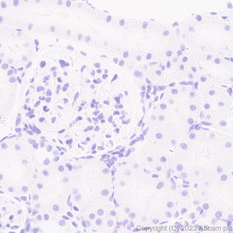 Anti-RS1 antibody [EPR28513-78](AB314231)