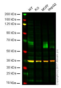 Anti-GBA antibody [2E2](AB55080)