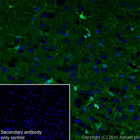 S100 Alpha Antibody Epr19013 Ab183979  Immunohistochemistry Frozen Sections Img71995