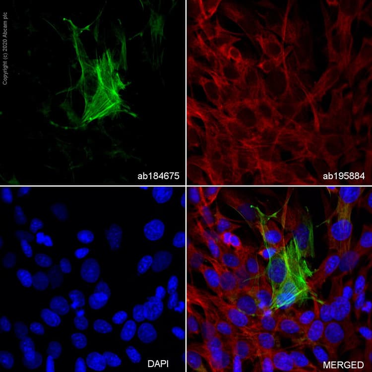 Alexa Fluor® 488 Anti-alpha smooth muscle Actin antibody [1A4](AB184675)