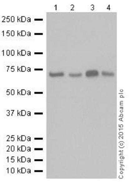 Anti-METTL3 antibody [EPR18810](AB195352)