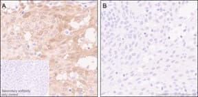 Pkc Delta Phospho S299 Antibody Epnci119 Ab133456  Immunohistochemistry Formalin Pfa Fixed Paraffin Embedded Sections Img427364