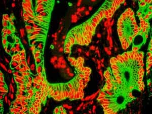 Anti-Cytokeratin 8 antibody [EP1628Y] - Cytoskeleton Marker(AB53280)