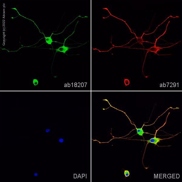 Beta Iii Tubulin Antibody Neuronal Marker Ab18207 Immunocytochemistry Immunofluorescence Img182462