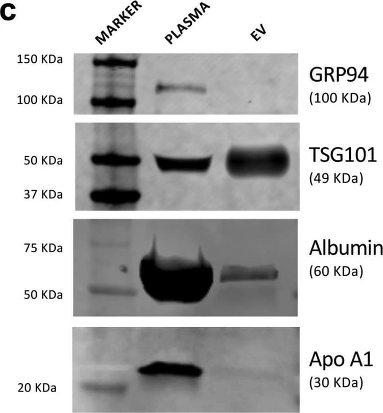 Grp94 Antibody Epr3988 Ab108606  Western Blot Img443276
