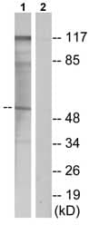 Parathyroid Hormone Receptor 1 Pth1r Antibody Ab75150  Western Blot Img146958