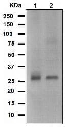 Bcl10 Antibody Epr3174 Ab108412  Western Blot Img89812