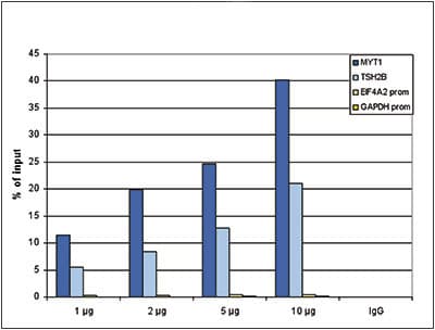 Anti-Histone H3 (tri methyl K27) antibody - ChIP Grade(AB195477)
