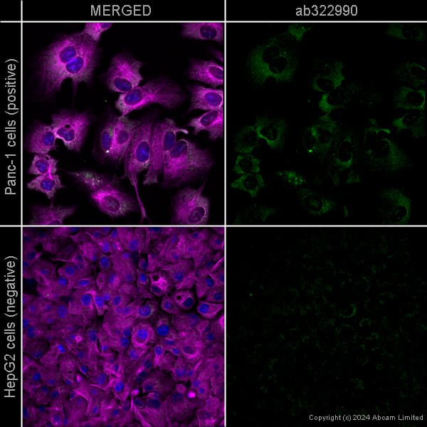Alexa Fluor 594 Alpha Tubulin Antibody Ep1332y Microtubule Marker Ab202272  Immunocytochemistry Immunofluorescence Img440907