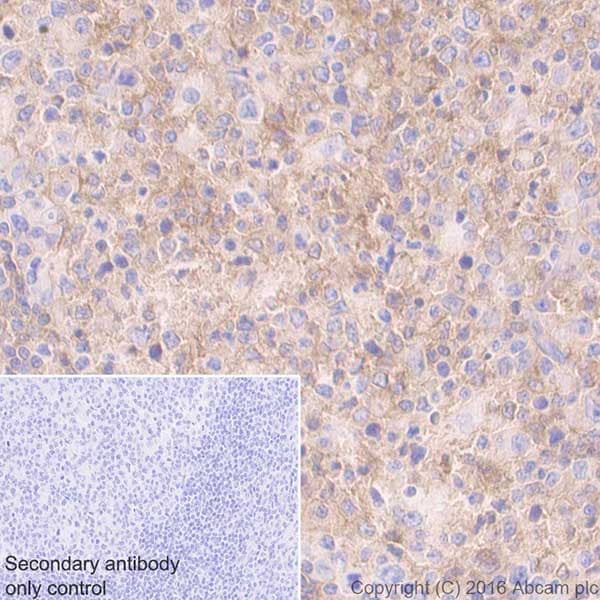 Cd40 Antibody Epr20540 Bsa And Azide Free Ab271995  Immunohistochemistry Formalin Pfa Fixed Paraffin Embedded Sections Img85462