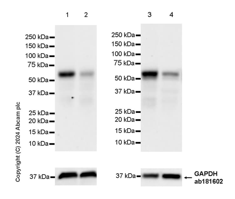 Rbpjk Antibody Rm2045 Ab317048  Western Blot Img432335