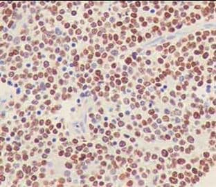 Anti-PHOX2B antibody [EPR14423] - C-terminal(AB183741)