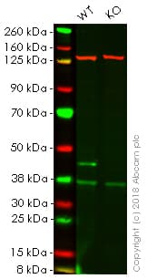 Anti-Glutamine Synthetase antibody [EPR13022(B)](AB176562)