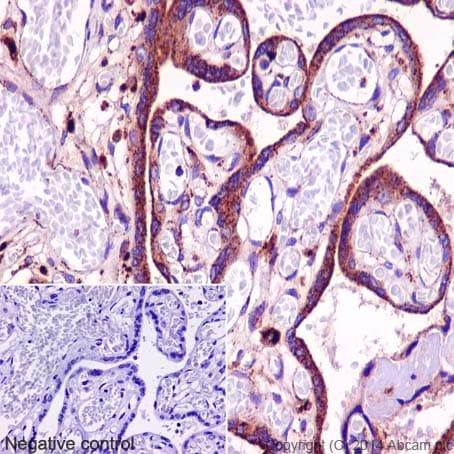 Tpp1 Antibody Epr16537 Ab195234  Immunohistochemistry Formalin Pfa Fixed Paraffin Embedded Sections Img110576