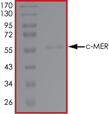 Ab72490  Sds Page Img145357