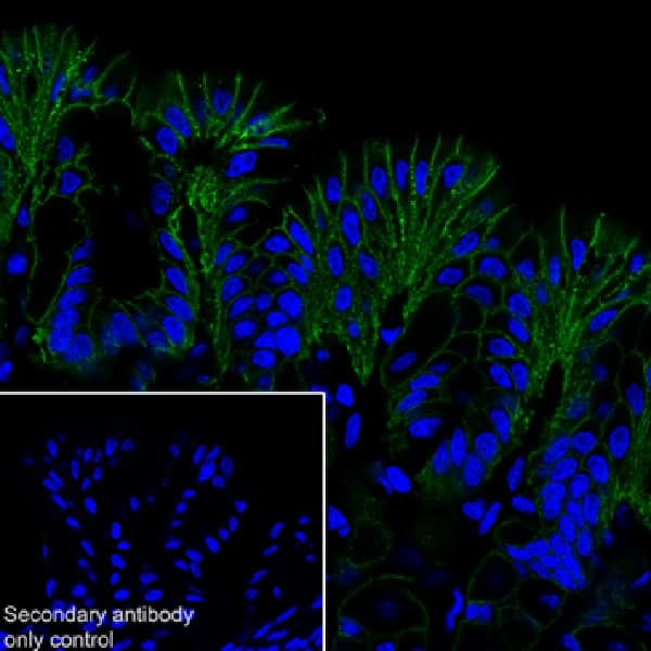 Anti-Claudin 18.2 antibody [EPR19202](AB222512)