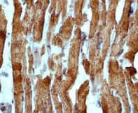 Cardiac Troponin I Antibody Ep1106y Bsa And Azide Free Ab182616  Immunohistochemistry Formalin Pfa Fixed Paraffin Embedded Sections Img13572