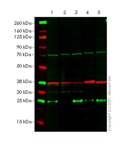 Anti-CBX1 / HP1 beta antibody [EPR24242-78](AB270988)