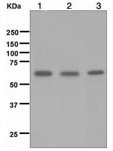 Neto2 Antibody Epr3497 Bsa And Azide Free Ab247819  Western Blot Img15606