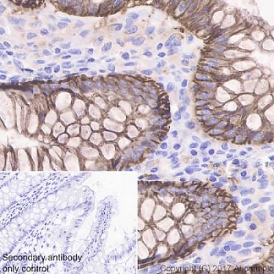Anti-EpCAM antibody [EPR20532-225](AB223582)