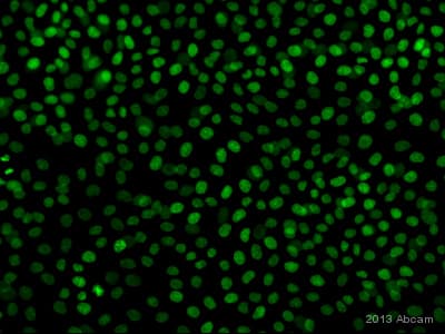 Anti-p63 antibody [EPR5701](AB124762)