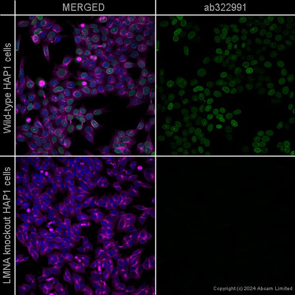 Alexa Fluor 594 Alpha Tubulin Antibody Ep1332y Microtubule Marker Ab202272  Immunocytochemistry Immunofluorescence Img440909