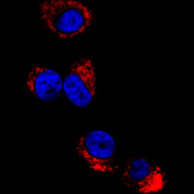 Anti-HA tag antibody(AB20084)