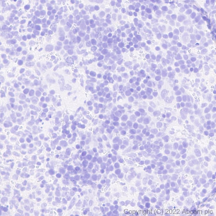 Anti-GFP antibody [EPR14104] - Chicken IgY (Chimeric)(AB300643)