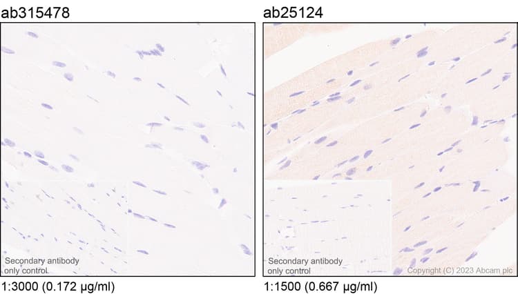 Anti-MCP1 antibody [RM1100](AB315478)