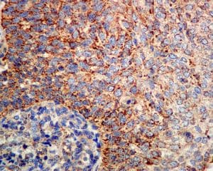 Anti-SOD2/MnSOD (acetyl K68) antibody [EPVANR2](AB137037)