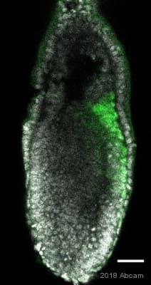 Anti-Brachyury / Bry antibody [EPR18113](AB209665)