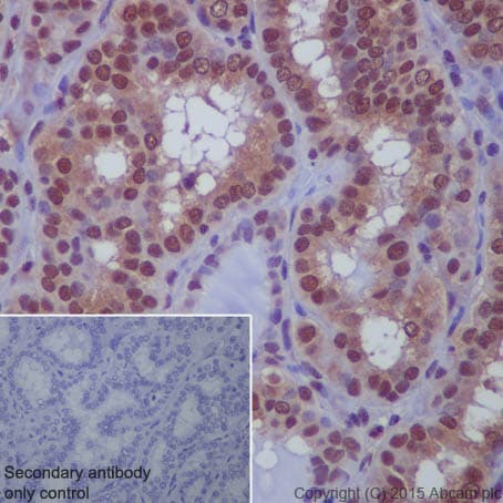Sumo 1 Antibody Ep298 Bsa And Azide Free Ab248491  Immunohistochemistry Formalin Pfa Fixed Paraffin Embedded Sections Img48248