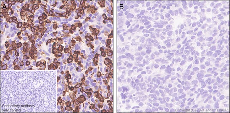 Anti-TRPA1/TSA antibody [EPR26211-139] - BSA and Azide free(AB320716)