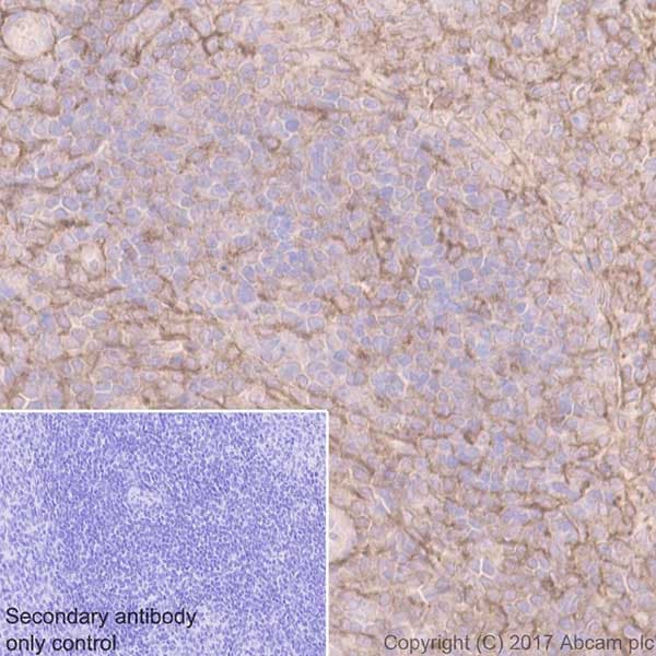 Anti-CD44 antibody [EPR18668](AB189524)