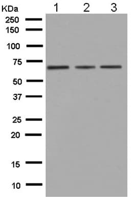 Anti-HYAL1 antibody [EPR5542](AB180143)