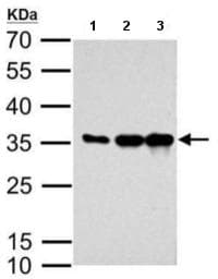 Anti-mCherry antibody(AB183628)