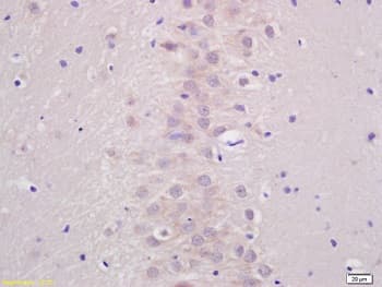 Anti-ATP7b antibody - C-terminal(AB217299)
