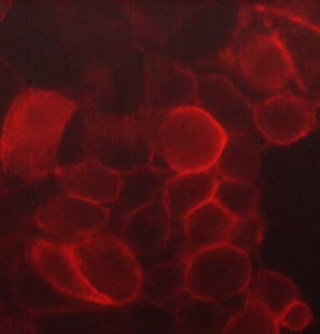 Cd44 Antibody M591 Ab253279  Immunocytochemistry Immunofluorescence Img131710