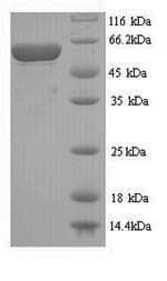 Recombinant Pneumolysin protein (His tag)(AB240861)