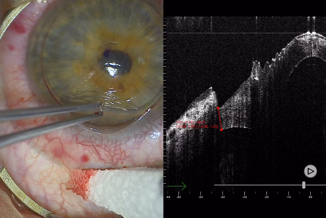 EnFocus Intraoperative OCT imaging system