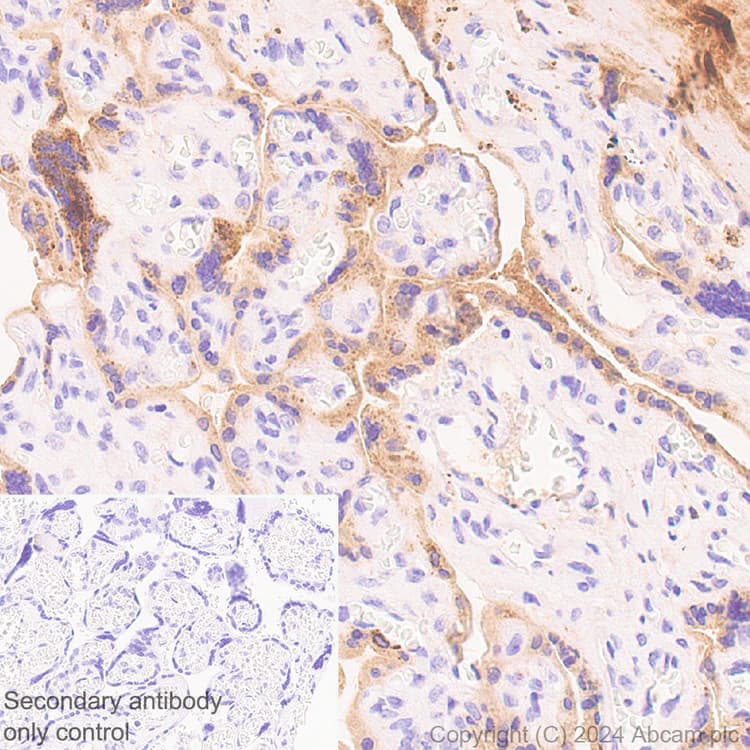Pai1 Antibody Epr21850 262 Bsa And Azide Free Ab317605  Immunohistochemistry Formalin Pfa Fixed Paraffin Embedded Sections Img431898