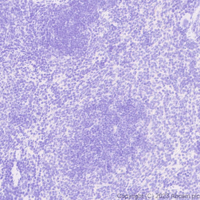 Anti-Stra8 antibody [EPR27083-56](AB308124)