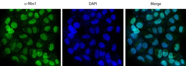 Anti-p95/NBS1 antibody(AB175800)