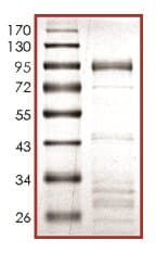 Recombinant human DYRK2 protein(AB133138)