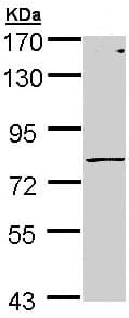 Polymeric Immunoglobulin Receptor Pigr Antibody Ab96196  Western Blot Img92680