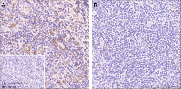 Anti-Lck (phospho Y394) antibody [EPR27974-93](AB318960)