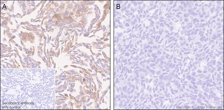 Anti-Alpha-synuclein antibody [MJFR1] - Mouse IgG2a (Chimeric)(AB309157)