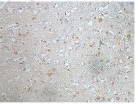 Anti-TIA1 antibody(AB205063)