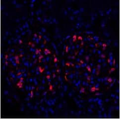 Anti-ZO1 tight junction protein antibody [BLR092G](AB276131)
