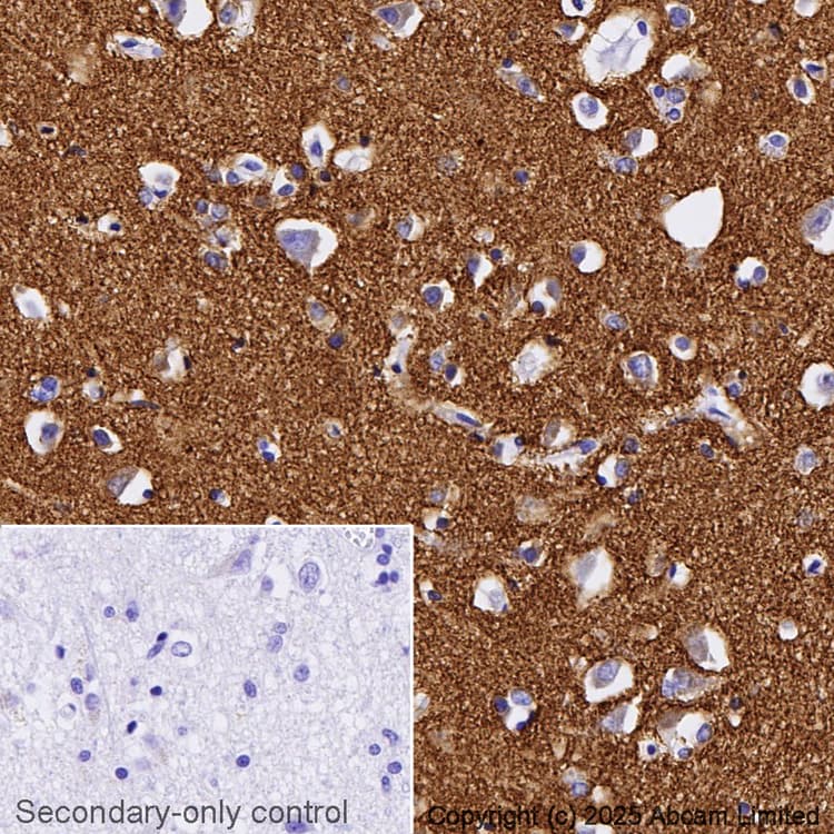 Anti-Synaptophysin antibody [YE269](ab32127)